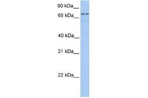 Transglutaminase 7 antibody used at 1 ug/ml to detect target protein. (Transglutaminase 7 抗体  (C-Term))