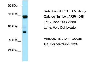 Western Blotting (WB) image for anti-Protein Phosphatase 1, Catalytic Subunit, gamma Isoform (PPP1CC) (C-Term) antibody (ABIN2789917) (PPP1CC 抗体  (C-Term))