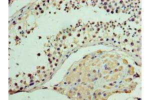 Immunohistochemistry of paraffin-embedded human testis tissue using ABIN7175278 at dilution of 1:100