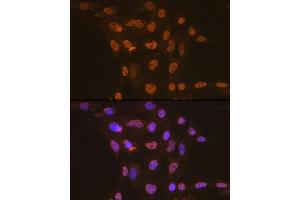 Immunofluorescence analysis of C6 cells using CDC16 Rabbit mAb (ABIN1678585, ABIN3017837, ABIN3017838 and ABIN7101525) at dilution of 1:100 (40x lens). (CDC16 抗体)