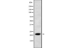 Western blot analysis IL28A using 293 whole cell lysates (IL28A 抗体  (N-Term))