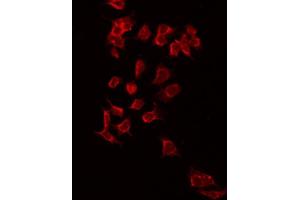 Immunofluorescence (fixed cells) (IF/ICC) image for anti-Potassium Inwardly-Rectifying Channel, Subfamily J, Member 3 (KCNJ3) (Internal Region) antibody (ABIN6262821)