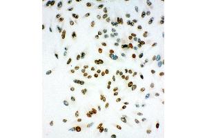 Anti-MCM6 antibody, ICC ICC: HELA Cell (MCM6 抗体  (Middle Region))