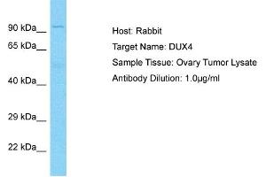 Host: Rabbit Target Name: DUX4 Sample Type: Ovary tumor lysates Antibody Dilution: 1. (DUX4 抗体  (N-Term))