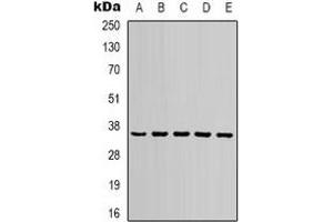 Western blot analysis of GAPDH expression in 293T (A), NIH3T3 (B), rat brain (C), sheep muscle (D), rabbit testis  (E) whole cell lysates. (GAPDH 抗体)