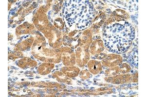 TMEM69 antibody was used for immunohistochemistry at a concentration of 4-8 ug/ml to stain EpitheliaI cells of renal tubule (arrows) in Human Kidney.