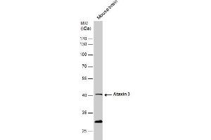 WB Image Ataxin 3 antibody detects Ataxin 3 protein by western blot analysis. (Ataxin 3 抗体)
