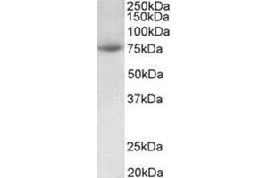 Western Blotting (WB) image for anti-Protein Arginine Methyltransferase 7 (PRMT7) (Internal Region) antibody (ABIN1108738) (PRMT7 抗体  (Internal Region))