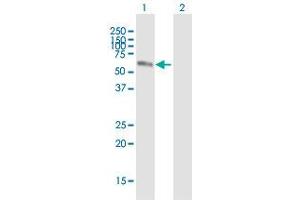 Western Blot analysis of NR2C2 expression in transfected 293T cell line (TR4 抗体  (AA 1-530))
