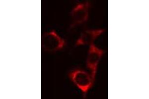ABIN6274720 staining Hela cells by IF/ICC. (MRPS18C 抗体  (Internal Region))