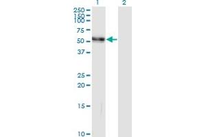 Western Blotting (WB) image for anti-Angiotensinogen (serpin Peptidase Inhibitor, Clade A, Member 8) (AGT) (AA 1-485) antibody (ABIN513185)