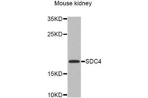 Western Blotting (WB) image for anti-Syndecan 4 (SDC4) (AA 19-145) antibody (ABIN6218959) (SDC4 抗体  (AA 19-145))
