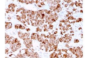 Immunohistochemistry (IHC) image for anti-Growth Hormone 1 (GH1) antibody (ABIN6939514)