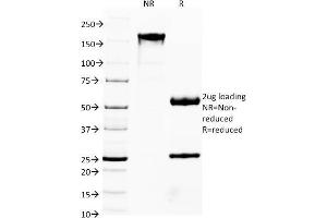 SDS-PAGE Analysis Purified FOXA1 Monoclonal Antibody (FOXA1/1541). (FOXA1 抗体  (AA 372-472))