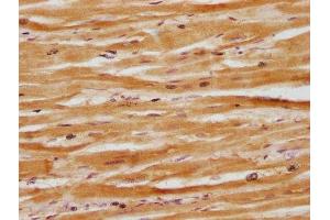 IHC image of ABIN7164419 diluted at 1:100 and staining in paraffin-embedded human heart tissue performed on a Leica BondTM system. (Deltex Homolog 3 抗体  (AA 90-347))
