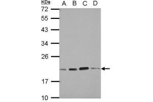 WB Image Sample (30 ug of whole cell lysate) A: A549 B: H1299 C: HCT116 D: MCF-7 12% SDS PAGE antibody diluted at 1:1000 (SKP1 抗体)