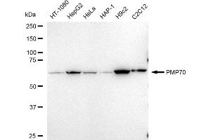 Western blotting analysis using PMP70 antibody (ABIN7797687).