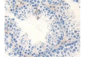 Detection of Smad4 in Mouse Testis Tissue using Polyclonal Antibody to Mothers Against Decapentaplegic Homolog 4 (Smad4) (SMAD4 抗体  (AA 9-231))