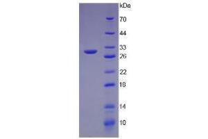 SDS-PAGE analysis of Human ITLN1 Protein. (ITLN1/Omentin 蛋白)
