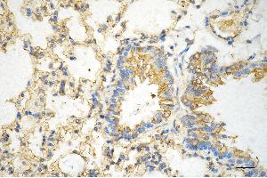 Immunohistochemistry was performed on paraffin-embedded mouse lung using AGL antibody (ABIN7797592), 1:200). (Recombinant AGL 抗体)