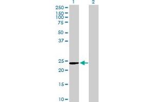 Western Blot analysis of C9orf95 expression in transfected 293T cell line by C9orf95 MaxPab polyclonal antibody. (NMRK1 抗体  (AA 1-199))