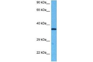 Host:  Rabbit  Target Name:  E2F5  Sample Tissue:  Human Jurkat Whole Cell  Antibody Dilution:  1ug/ml (E2F5 抗体  (N-Term))