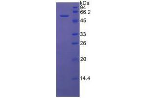 SDS-PAGE analysis of Rat HMWK Protein. (Kininogen (HMW) 蛋白)