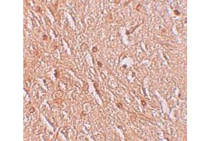 Immunohistochemical staining of human brain cells with LMBRD1 polyclonal antibody  at 2. (LMBRD1 抗体  (C-Term))