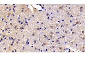 Detection of FADD in Mouse Cerebrum Tissue using Polyclonal Antibody to Fas Associating Death Domain Containing Protein (FADD) (FADD 抗体  (AA 7-178))