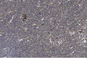 Immunohistochemical analysis of paraffin-embedded Human Thymus section using Pink1 am2199b. (H2AFX 抗体  (C-Term))