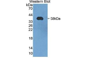 Western blot analysis of the recombinant protein. (PMM1 抗体  (AA 2-262))