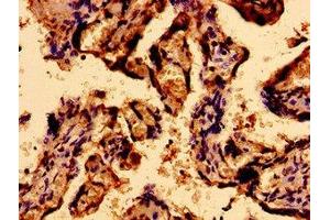 Immunohistochemistry of paraffin-embedded human placenta tissue using ABIN7168566 at dilution of 1:100 (Sacsin 抗体  (AA 983-1150))
