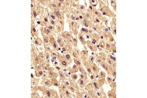 (ABIN6242565 and ABIN6578213) staining PGM1 in human liver tissue sections by Immunohistochemistry (IHC-P - paraformaldehyde-fixed, paraffin-embedded sections). (Phosphoglucomutase 1 抗体  (AA 469-501))