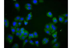 Immunofluorescence staining of HepG2 cells with ABIN7150084 at 1:166, counter-stained with DAPI. (DLGAP2 抗体  (AA 31-139))