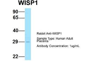 Host: Rabbit  Target Name: WISP1  Sample Tissue: Human Adult Placenta  Antibody Dilution: 1. (WISP1 抗体  (Middle Region))