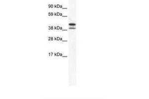 Image no. 1 for anti-TATA Box Binding Protein Like 2 (Tbpl2) (AA 53-102) antibody (ABIN202310) (Tbpl2 抗体  (AA 53-102))