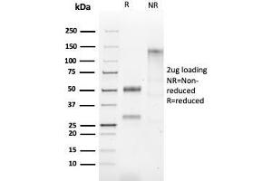 SDS-PAGE Analysis of Purified HSP60 Rabbit Recombinant Monoclonal Antibody (HSPD1/2206R). (Recombinant HSPD1 抗体)