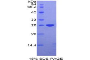 SDS-PAGE analysis of Mouse DIXDC1 Protein. (DIXDC1 蛋白)