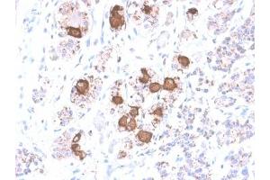 IHC testing of FFPE human pituitary gland with recombinant ACTH antibody (clone CLIP/2040R). (CLIP 抗体  (AA 25-39))