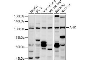 Western blot analysis of extracts of various cell lines, using AHR antibody (ABIN3015499, ABIN3015500, ABIN5663909 and ABIN6218543) at 1:1000 dilution. (Aryl Hydrocarbon Receptor 抗体  (AA 619-848))