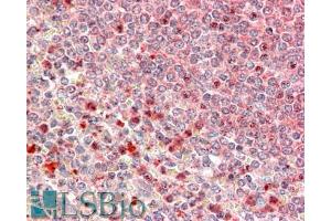 ABIN570777 (5µg/ml) staining of paraffin embedded Human Spleen. (UBR4 抗体  (C-Term))