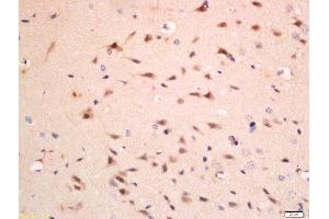 Paraformaldehyde-fixed, paraffin embedded rat brain, Antigen retrieval by boiling in sodium citrate buffer (pH6) for 15min, Block endogenous peroxidase by 3% hydrogen peroxide for 30 minutes, Blocking buffer (normal goat serum) at 37°C for 20min, Antibody incubation with Rabbit Anti-C1QC/C1QG Polyclonal Antibody, Unconjugated  at 1:200 overnight at 4°C, followed by a conjugated secondary for 90 minutes and DAB staining. (C1QC 抗体  (AA 81-180))