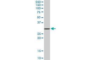 STX4A monoclonal antibody (M02), clone 6A1. (Syntaxin 4 抗体  (AA 19-119))