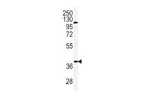 Western blot analysis of ADIPOR2 Antibody (Center) (ABIN651298 and ABIN2840176) in Hela cell line lysates (35 μg/lane). (Adiponectin Receptor 2 抗体  (AA 45-72))