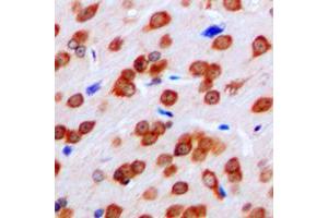 Immunohistochemical analysis of FPR1 staining in human brain formalin fixed paraffin embedded tissue section. (FPR1 抗体  (Center))