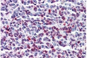 Human Tonsil: Formalin-Fixed, Paraffin-Embedded (FFPE) (DENND1B 抗体  (AA 108-157))