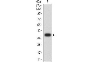 Western blot analysis using BTLA mAb against human BTLA (AA: 179-289) recombinant protein. (BTLA 抗体  (AA 179-289))