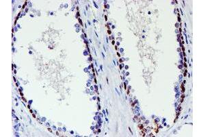 Image no. 2 for anti-WW Domain Containing Transcription Regulator 1 (WWTR1) antibody (ABIN1501763) (WWTR1 抗体)
