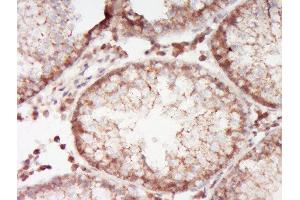 Paraformaldehyde-fixed, paraffin embedded rat testis, Antigen retrieval by boiling in sodium citrate buffer (pH6. (ABCA12 抗体  (AA 2051-2200))