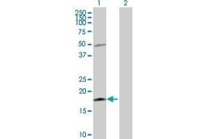 Western Blotting (WB) image for anti-Interleukin 21 (IL21) (AA 1-162) antibody (ABIN528381)
